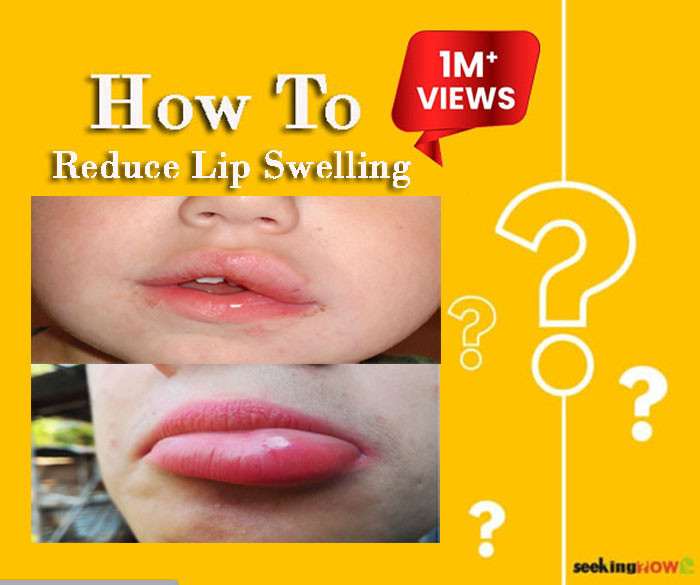 How To Reduce Lip Swelling