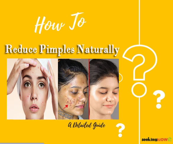 How To Reduce Pimples Naturally