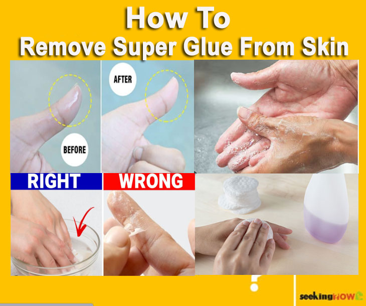 How To Remove Super Glue From Skin