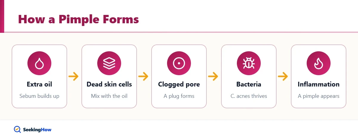 Diagram showing how pimples form, to help reduce pimples naturally
